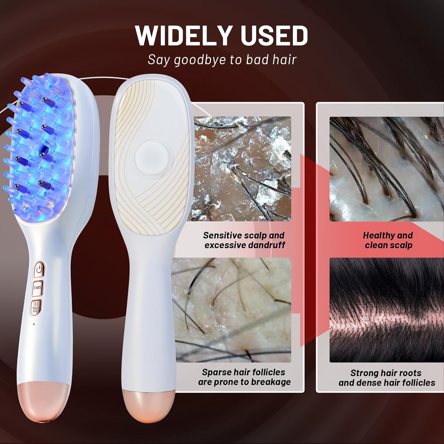 Electric Hair Steamer Brush,Microcurrent Massage Comb for Head,Red & Blue Light Hair Care,Vibration Scalp Massage Atomization Comb