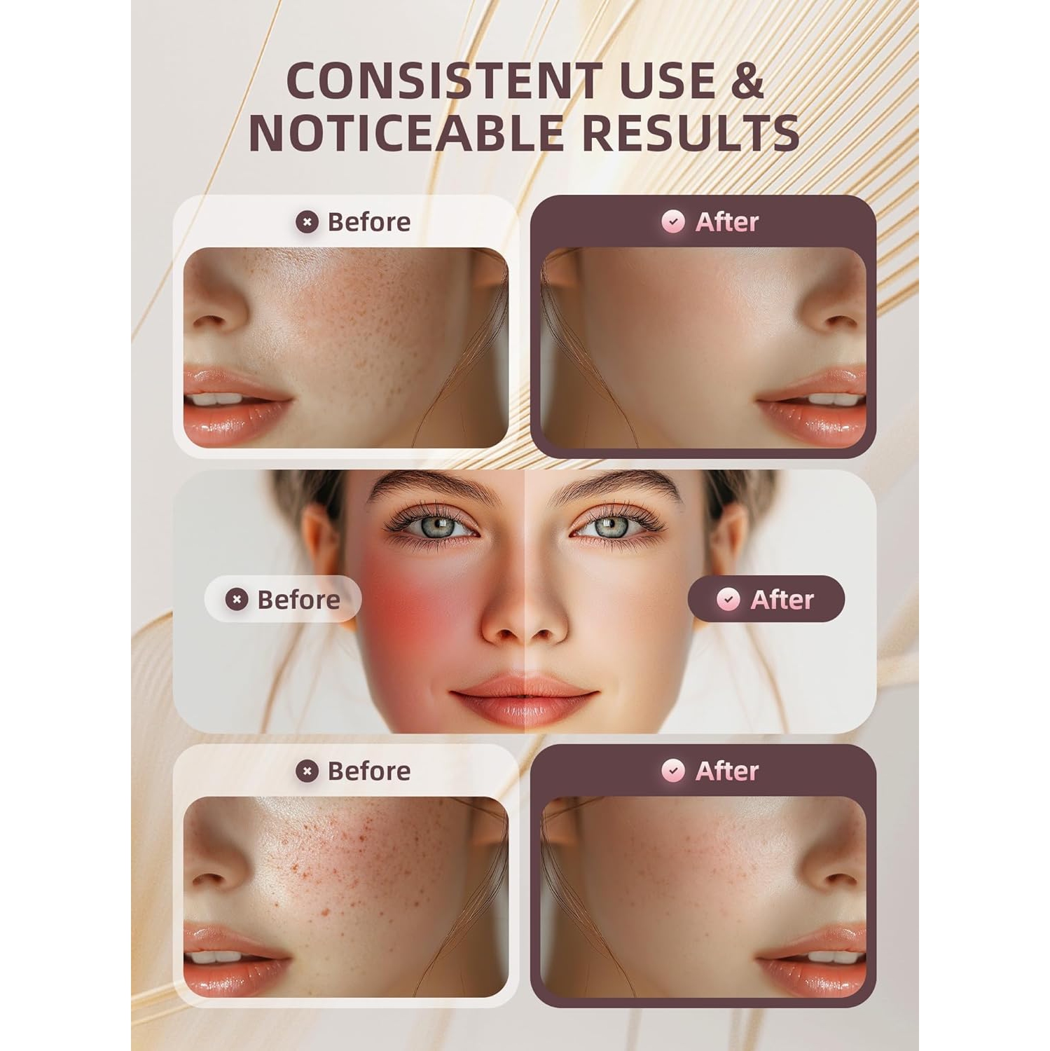 Masseur facial Outil de beauté pour le visage et le cou,Appareil de soin de la peau pour le salon de beauté,Appareil de beauté de massage