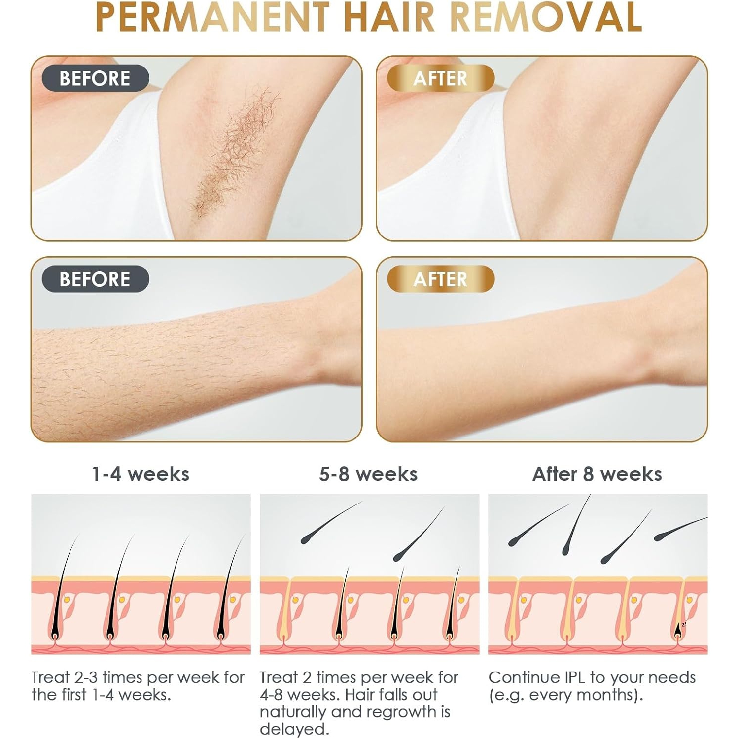 Home Hair Removal Device Portable Handheld Facial Whole Body Painless Intense Pulse Laser IPL Hair Removal Device