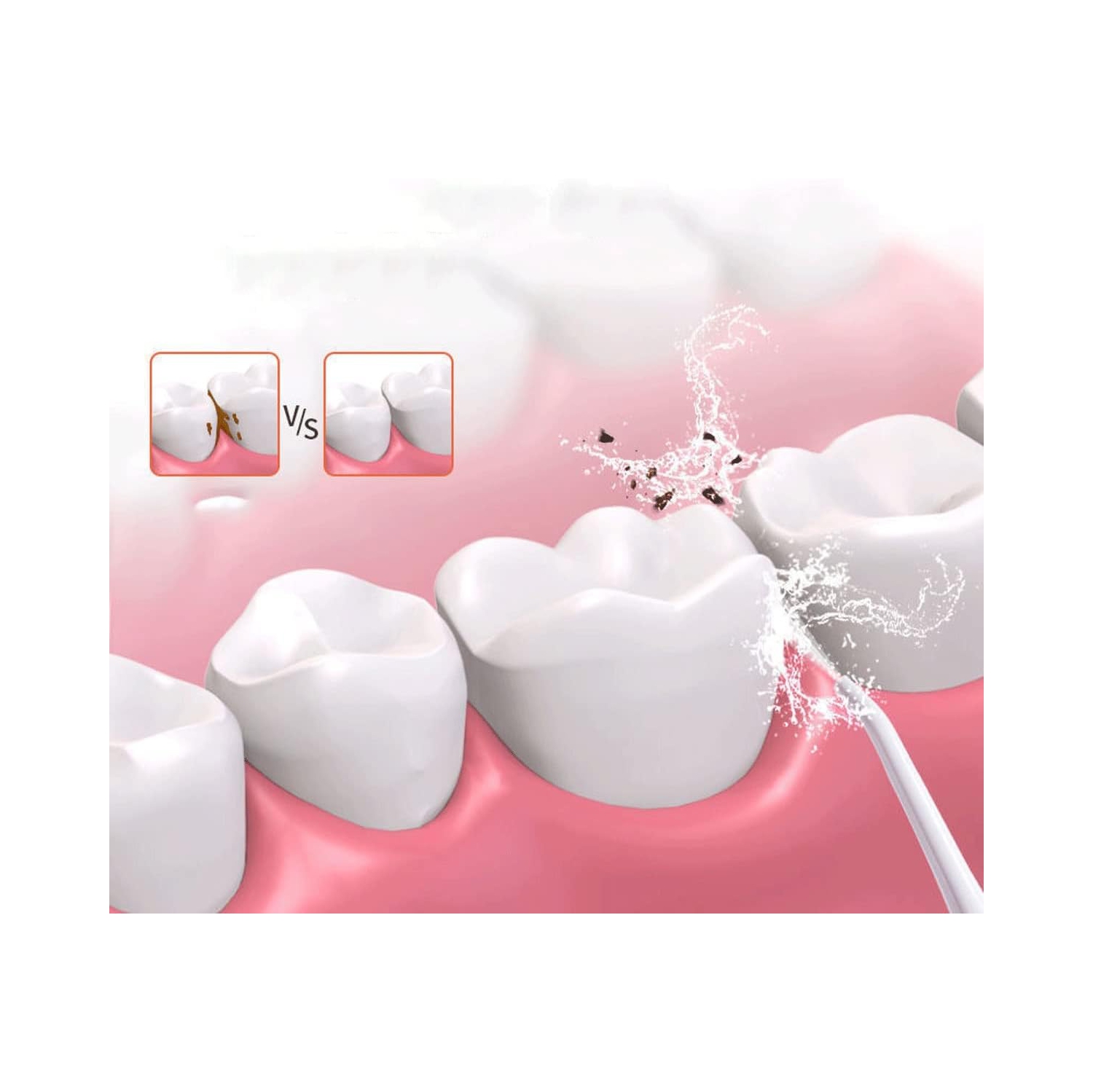 Cordless Advanced Water Flosser for Teeth, Gums, Braces, Gums, Braces, Dental Care, Cordless Dental Oral Irrigator - 3 Modes, 3 Tips for Family