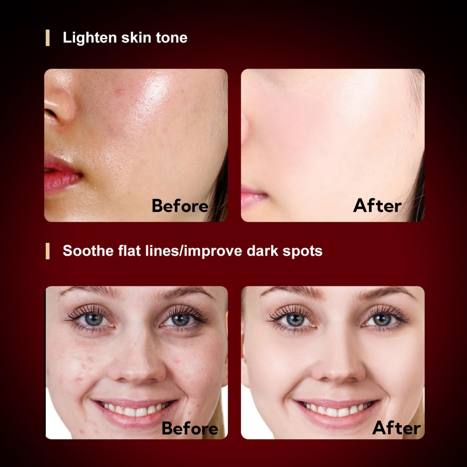 Panneau de thérapie à la lumière rouge pour le visage et le corps, lampe de beauté avec lunettes de protection, salon et utilisation à la maison,