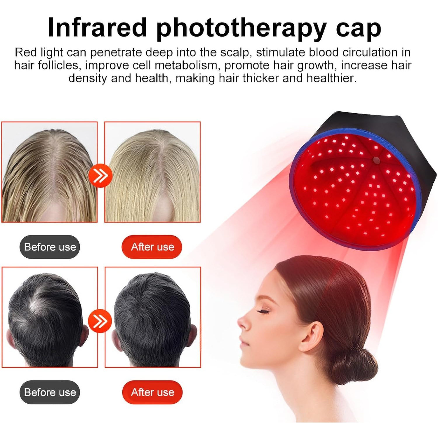 Unisex Red Light Therapy Cap Dual Wavelength Light Therapy Cap Improves Scalp Health, Reduces Dandruff, Improves Gloss, Hair Regrowth Device