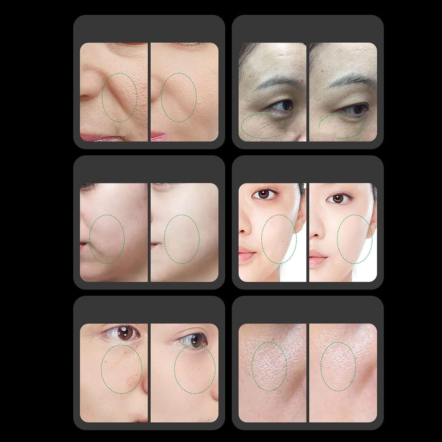 Radio Frequency Radio Frequency Spa Machine Anti-wrinkle Skin Firming Beauty Care Device Collagen