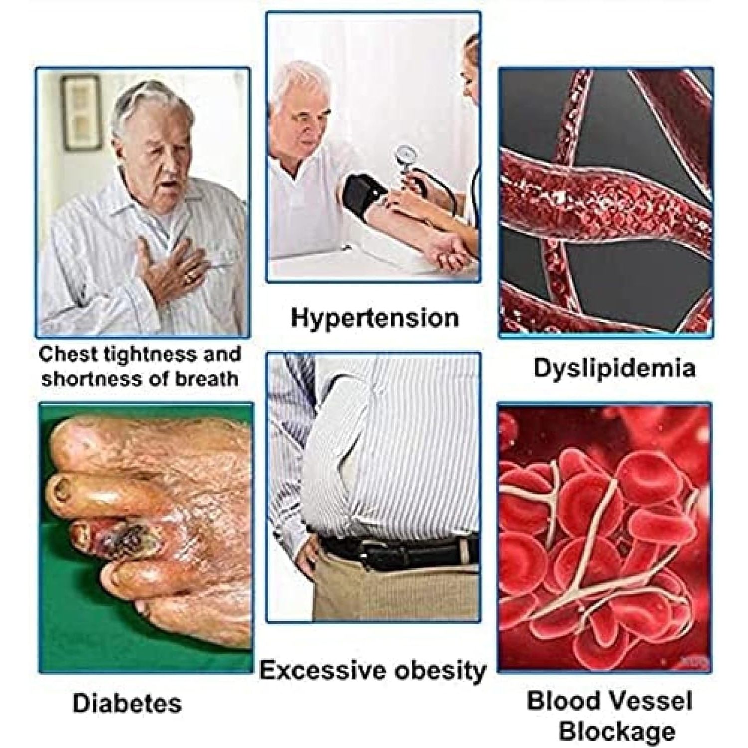 Laser therapy watch, 650nm semiconductor laser therapy device, hypertension, hyperglycemia, hyperlipidemia therapy device