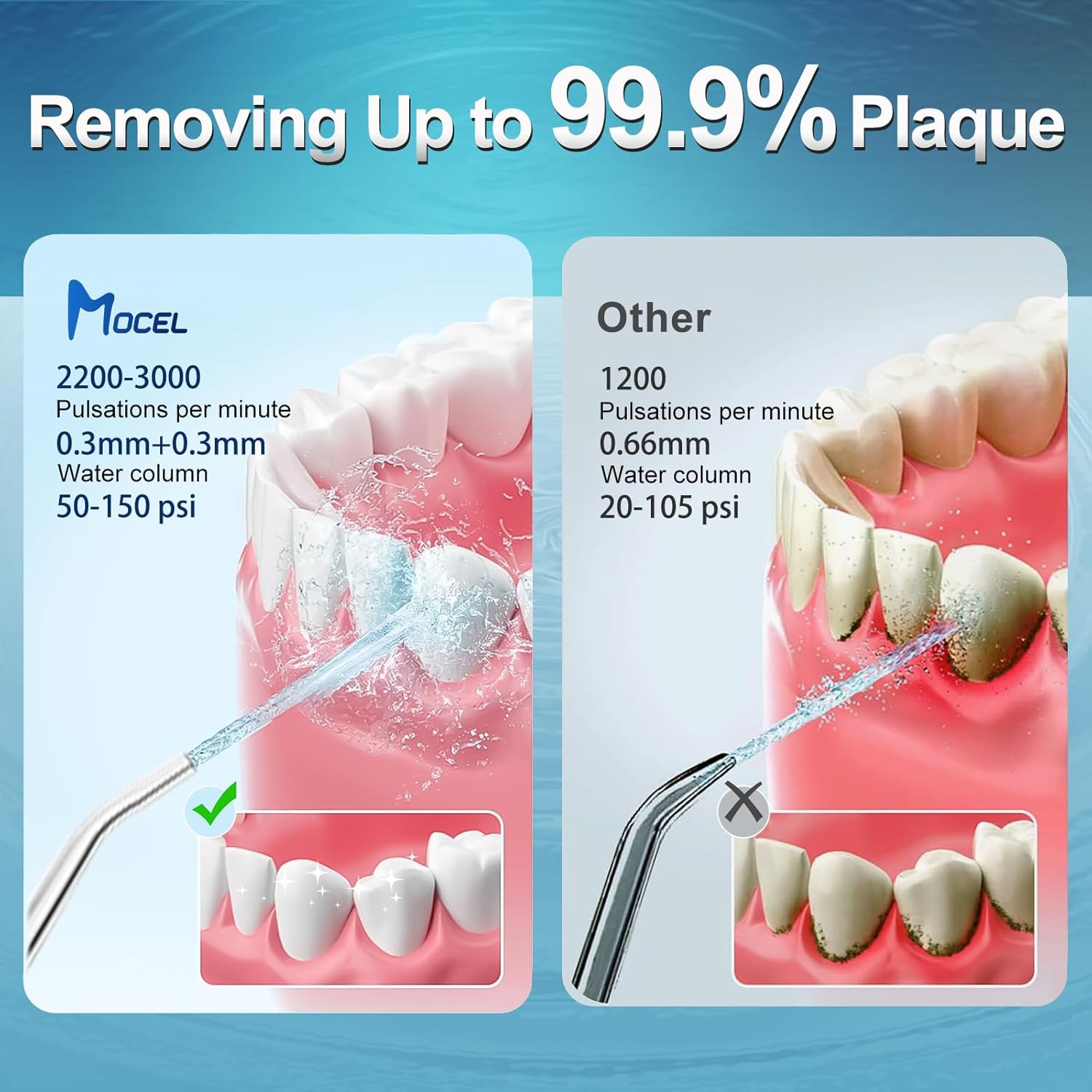 Hydropulseur à eau de Mocel - Nettoyage de dents sans fil, 5 modes, Irrigateur oral portatif de 350 ml, rechargeable USB-C, étanche IPX7, pour la