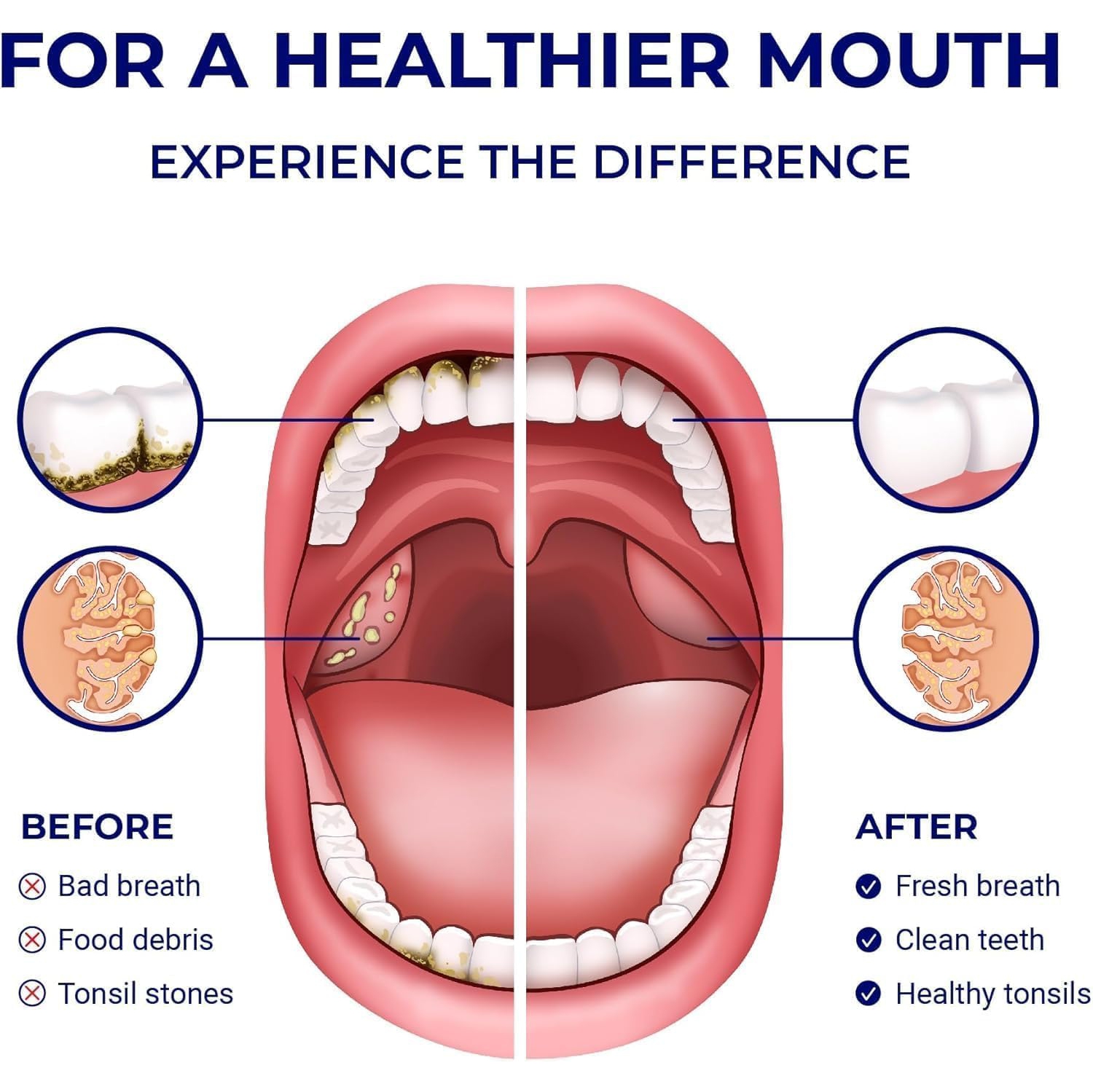 ORAVIX Manual Dental Water Flosser and Tonsil Stone Remover - Oral Irrigator for Sensitive Teeth and Gums