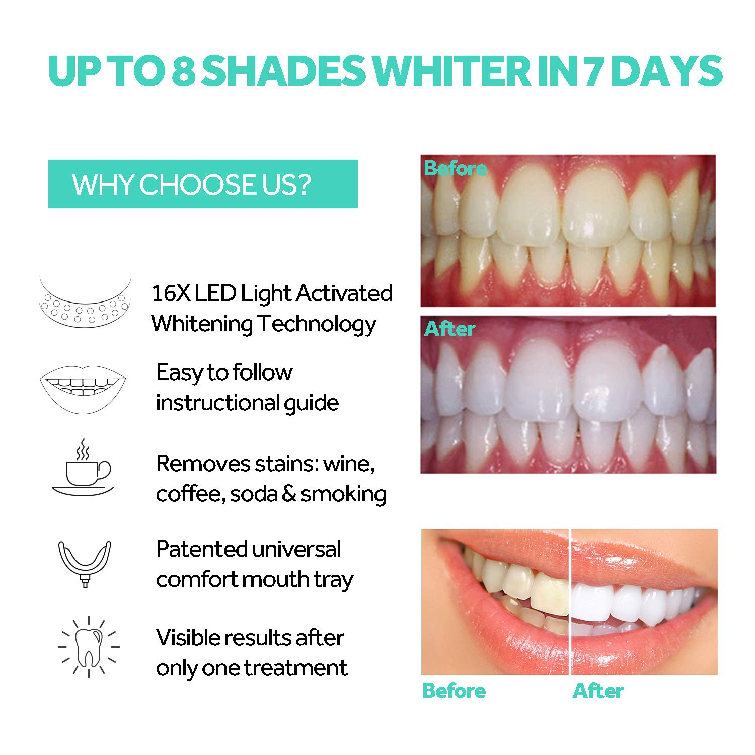 Teeth Whitening Accelerator Light, Blue Light LED Teeth Whitening Enhancement Light, Suitable for Travel and Home Use