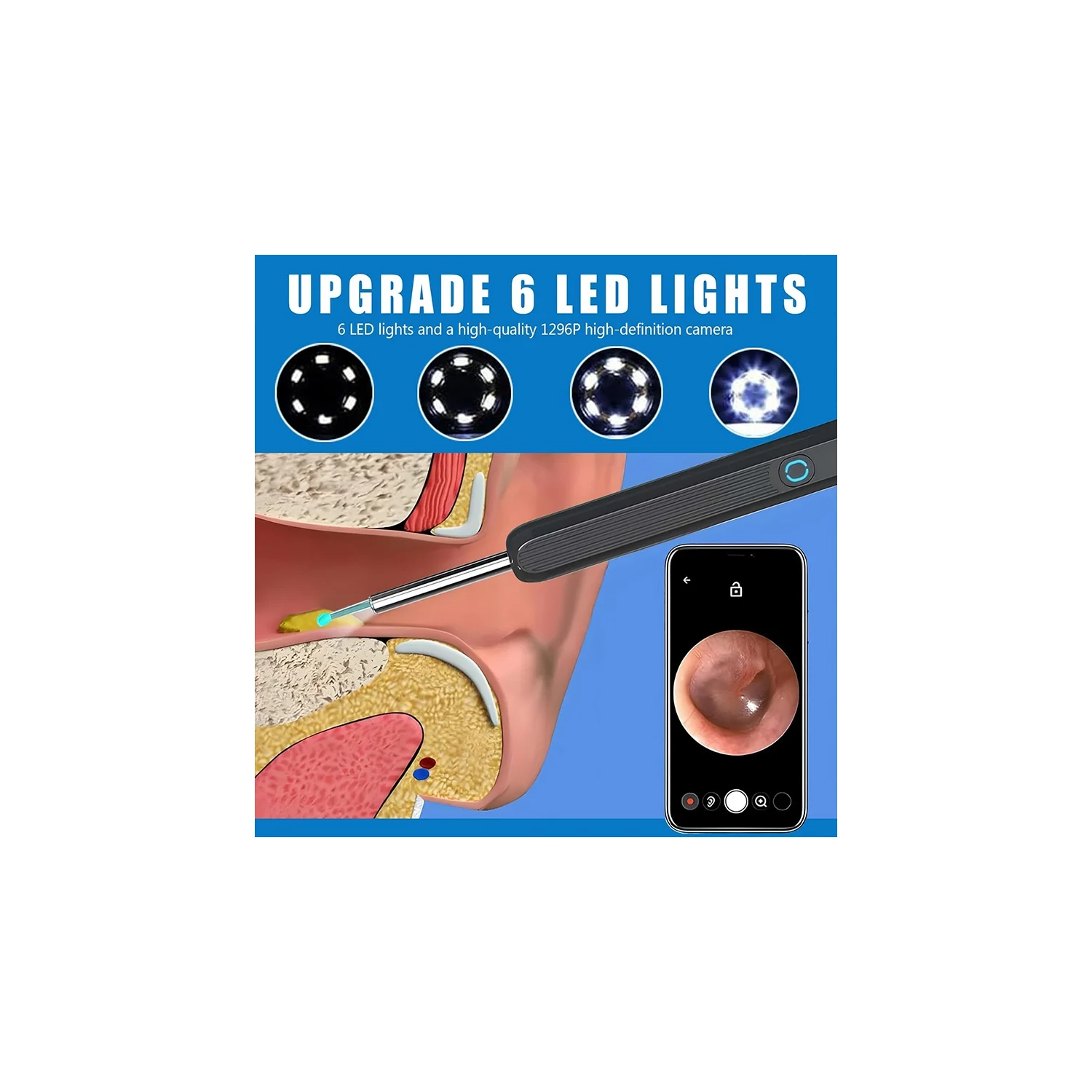 Retrait de cire d'oreille, trousse de retrait de cire d'oreille avec caméra HD, trousse de nettoyage d'oreille Otoscope avec lumière, caméra