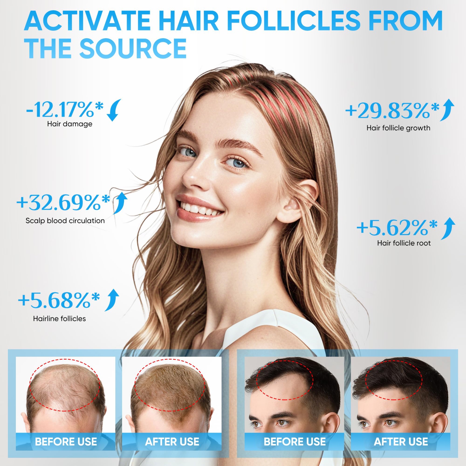 Hair Growth Device, 678nm Red Light Therapy System, Suitable for Thinning Hair, Hair Loss Treatment, Scalp Health Restoration