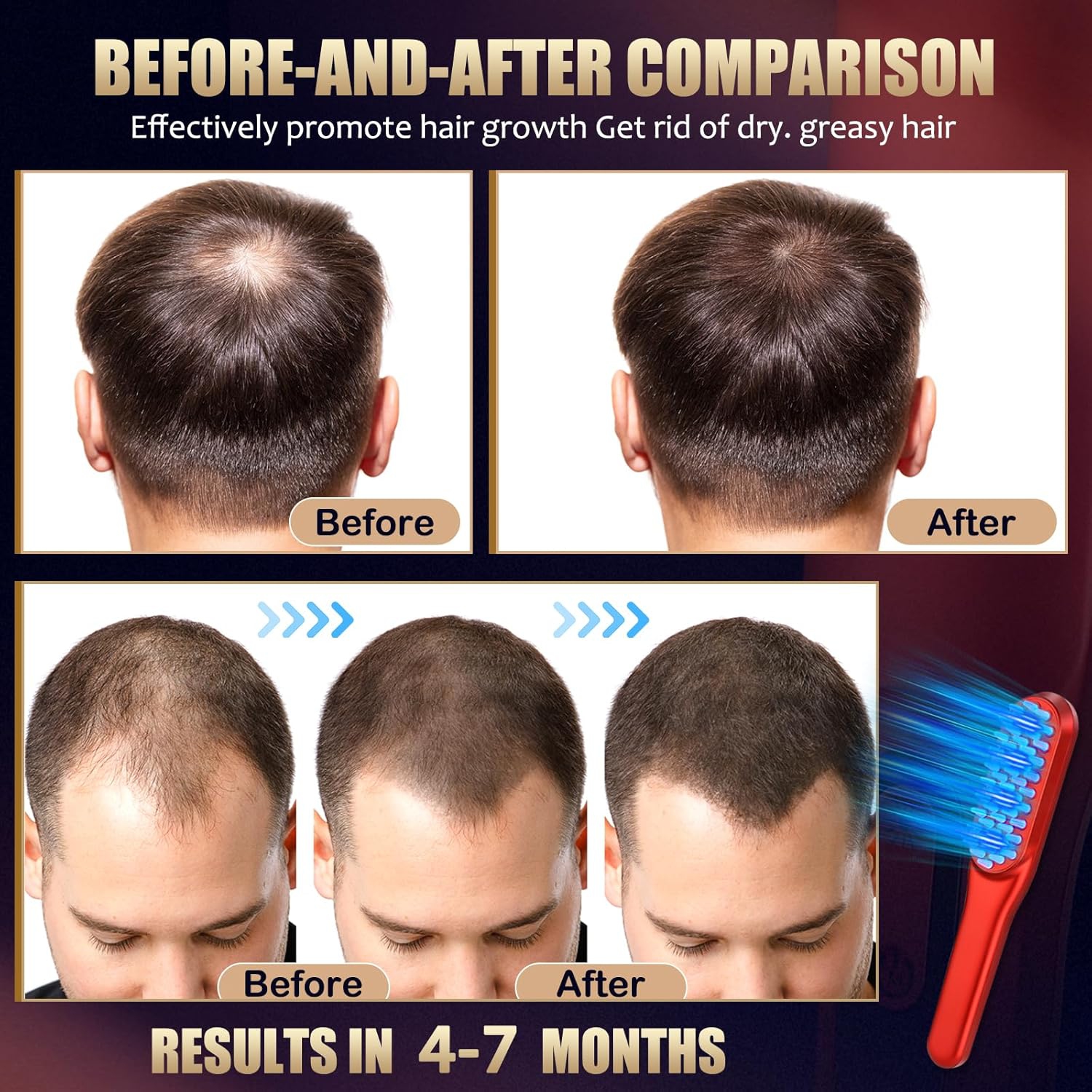 Laser Hair Growth Comb，Red Light Hair Growth Treatment for Men & Women