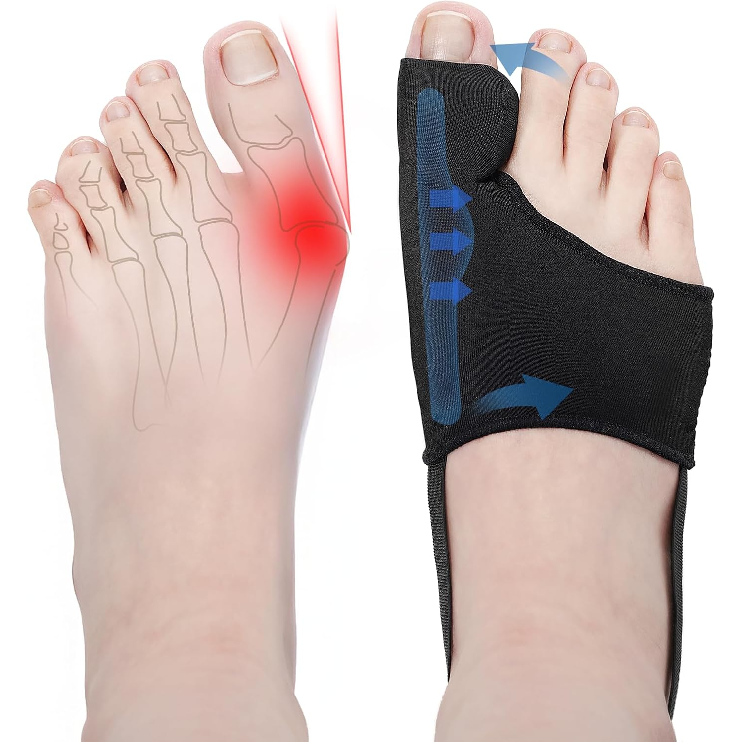 2PCS Bunion Corrector for Women & Men Big Toe Straightener,Bunions Correction Splint-Bunion Pads for Bunion Relief,Breathable Day & Night