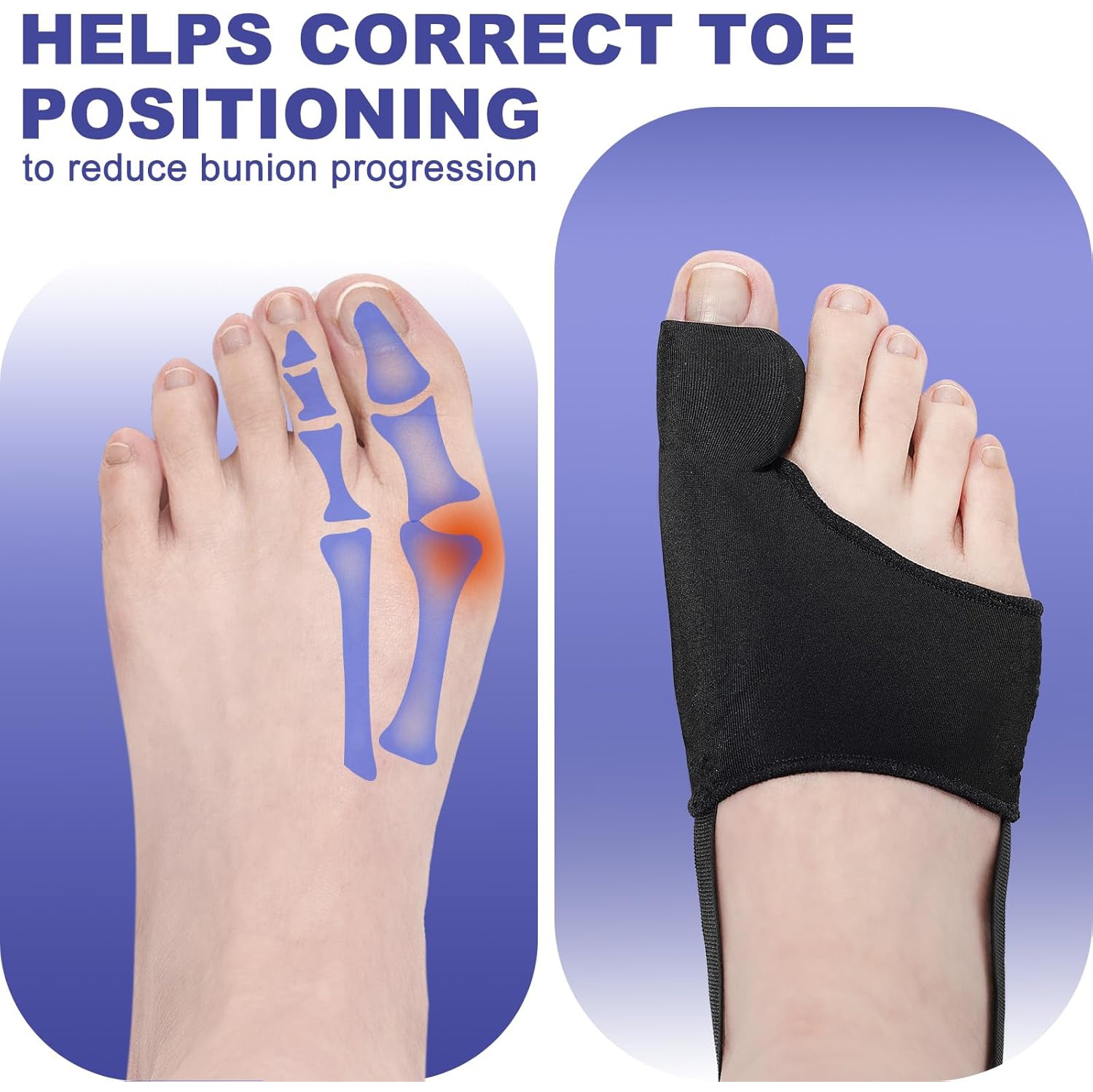 2PCS Bunion Corrector for Women & Men Big Toe Straightener,Bunions Correction Splint-Bunion Pads for Bunion Relief,Breathable Day & Night