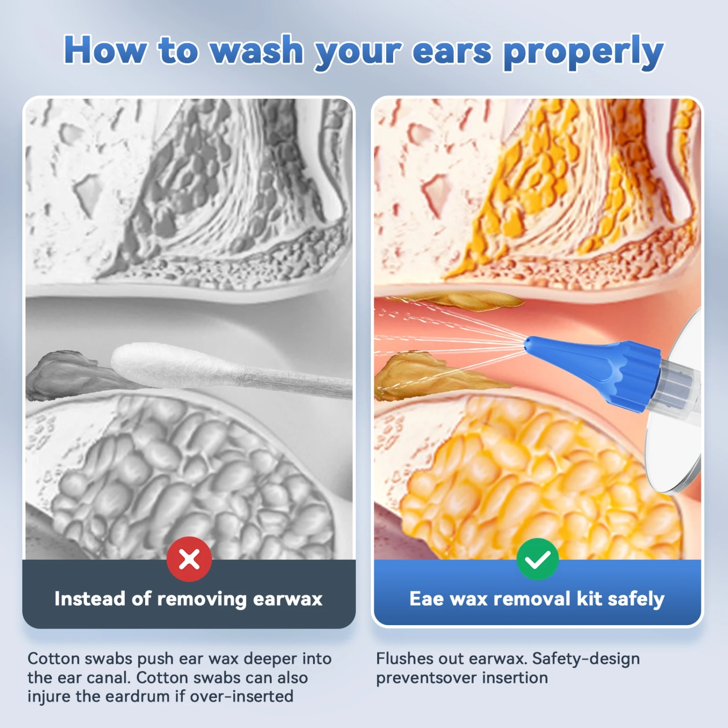 Nettoyeur d'oreilles électrique, outil d'enlèvement de cire d'oreille portatif pour la maison