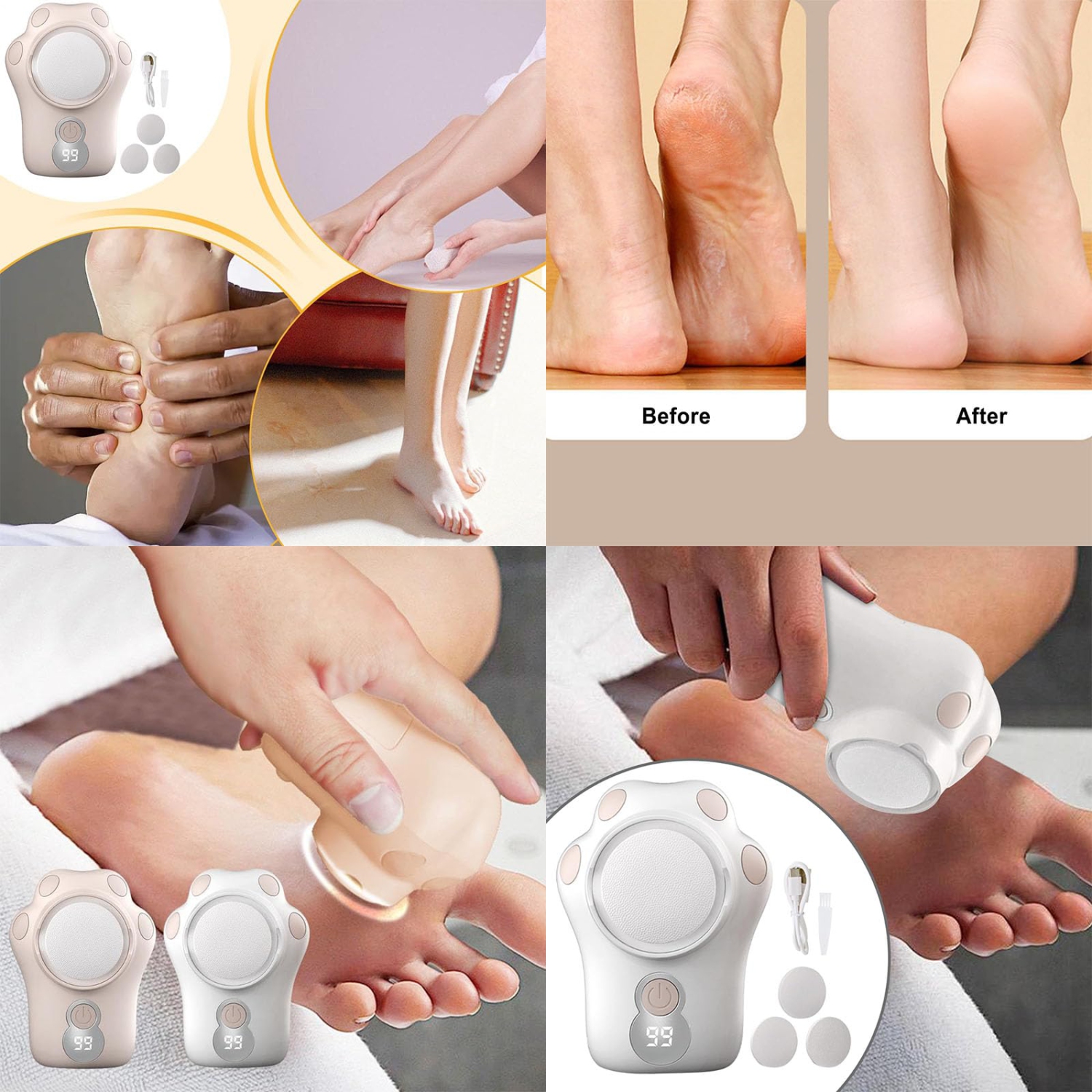 Moulin à pieds électrique avec lumière violette, boîte de rangement et écran numérique, moulin à pieds portatif sans fil pour le soin des pieds à la