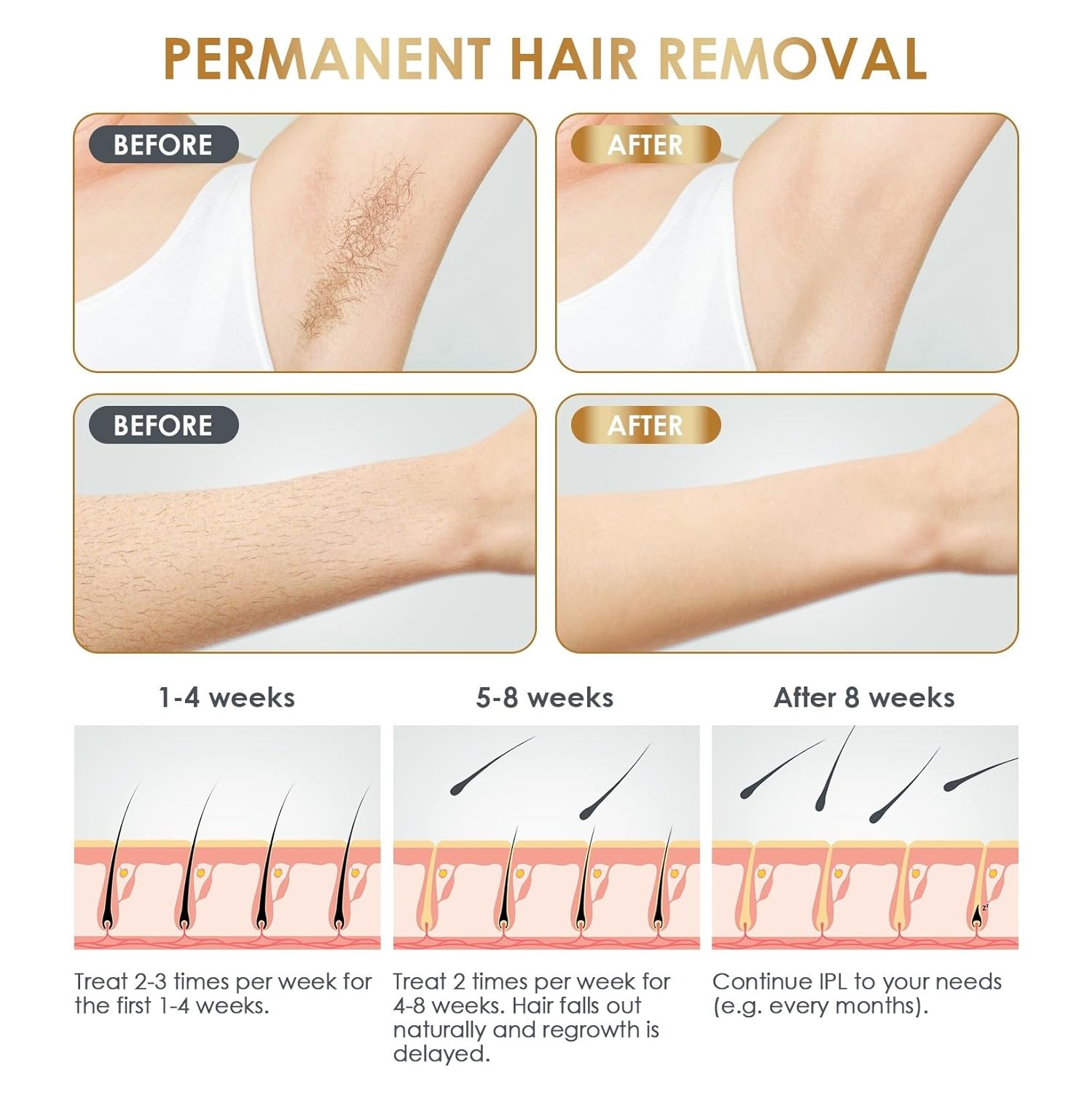 IPL Laser Hair Removal Device at-Home for Women Men Painless Permanent Hair Removal for Facial Upper Lip Bikini Line Armpits Back Legs Arms Whole