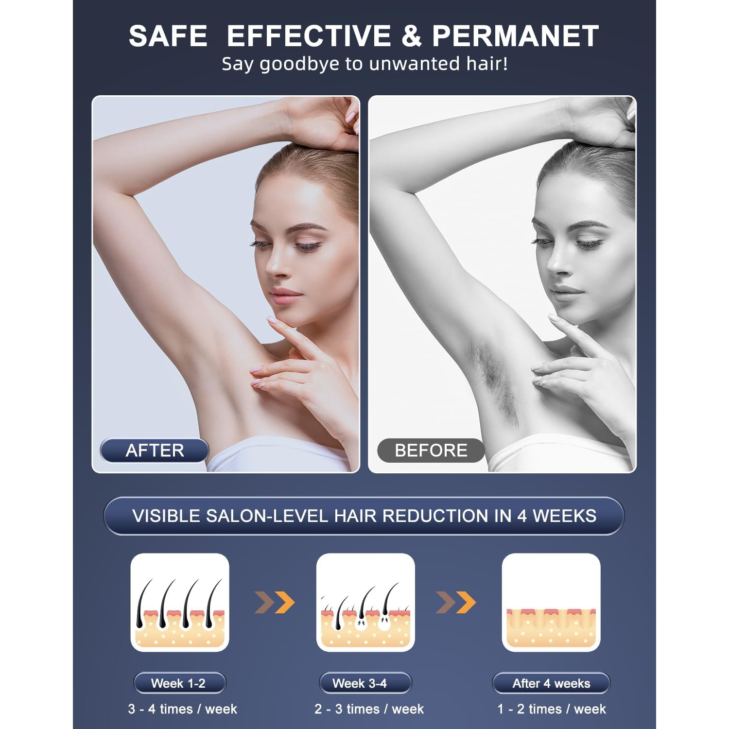 Laser Hair Removal,IPL Hair Removal Permanent for Women and Men,Hair Removal Device 999999 Flashes at-Home for Facial Legs Arms Whole Body