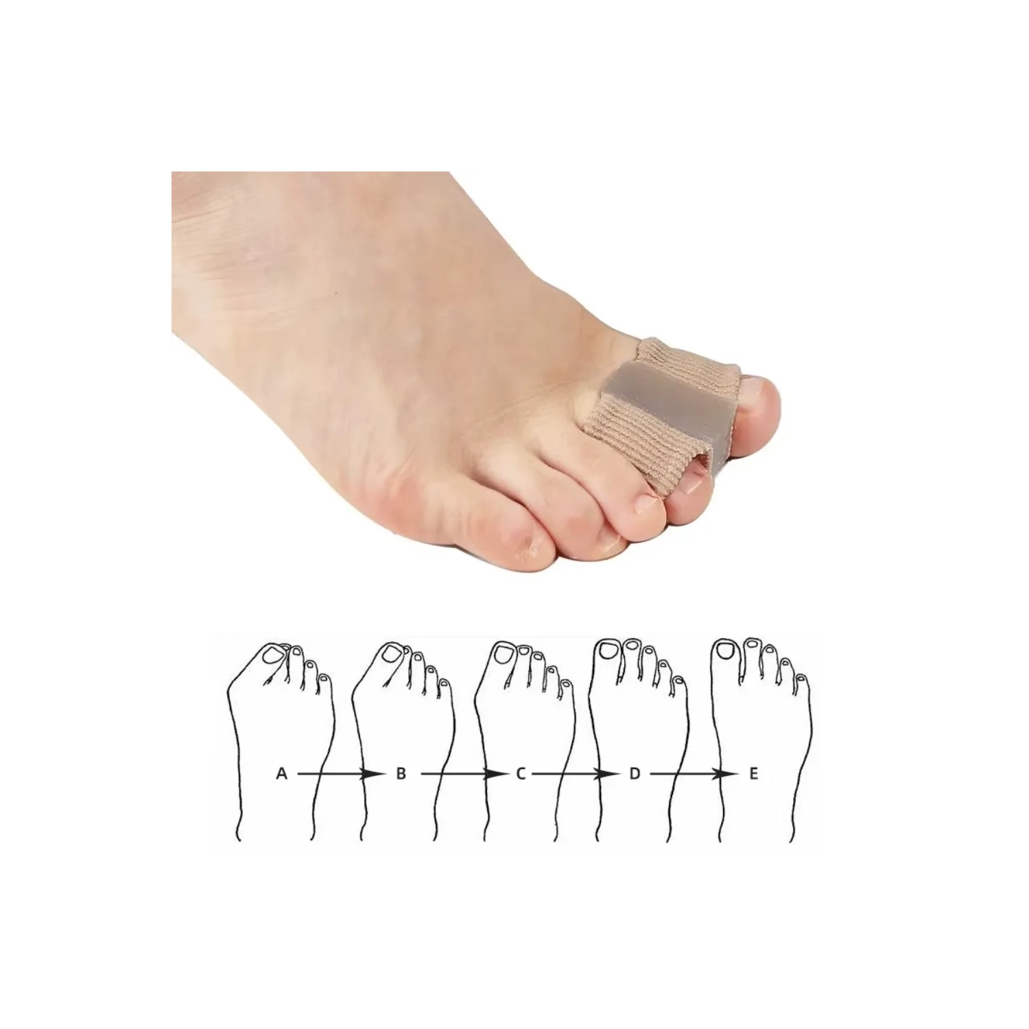 4 pièces de réglage de séparation à deux embouts en silicone Outil de correction efficace de raccord Hallux Valgus correcteur de raidisseur de