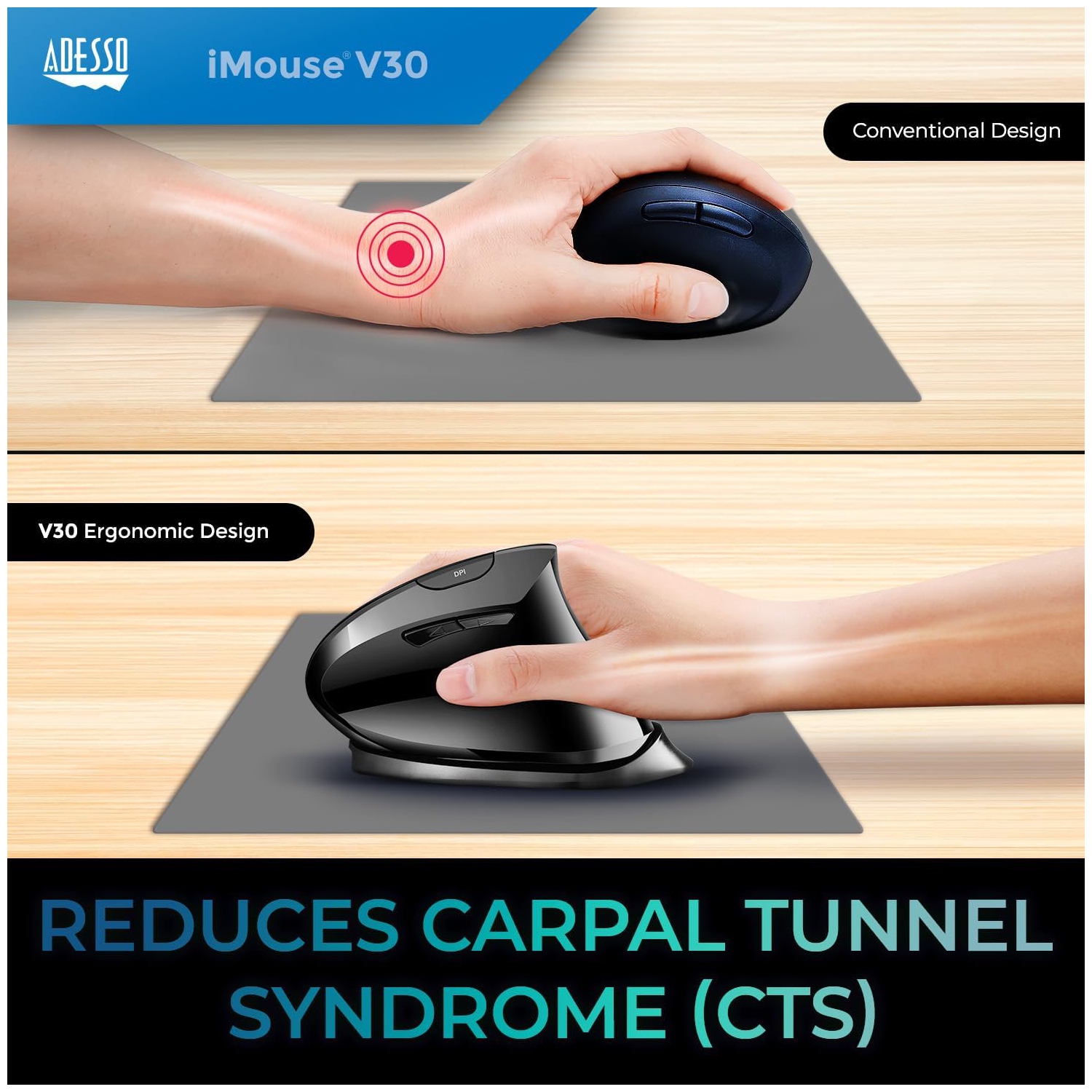 Adesso iMouse V30 Wireless Adjustable Vertical Ergonomic Mouse with Customizable Angles and DPI Switch - Advanced Optical Sensor Technology, Reduces