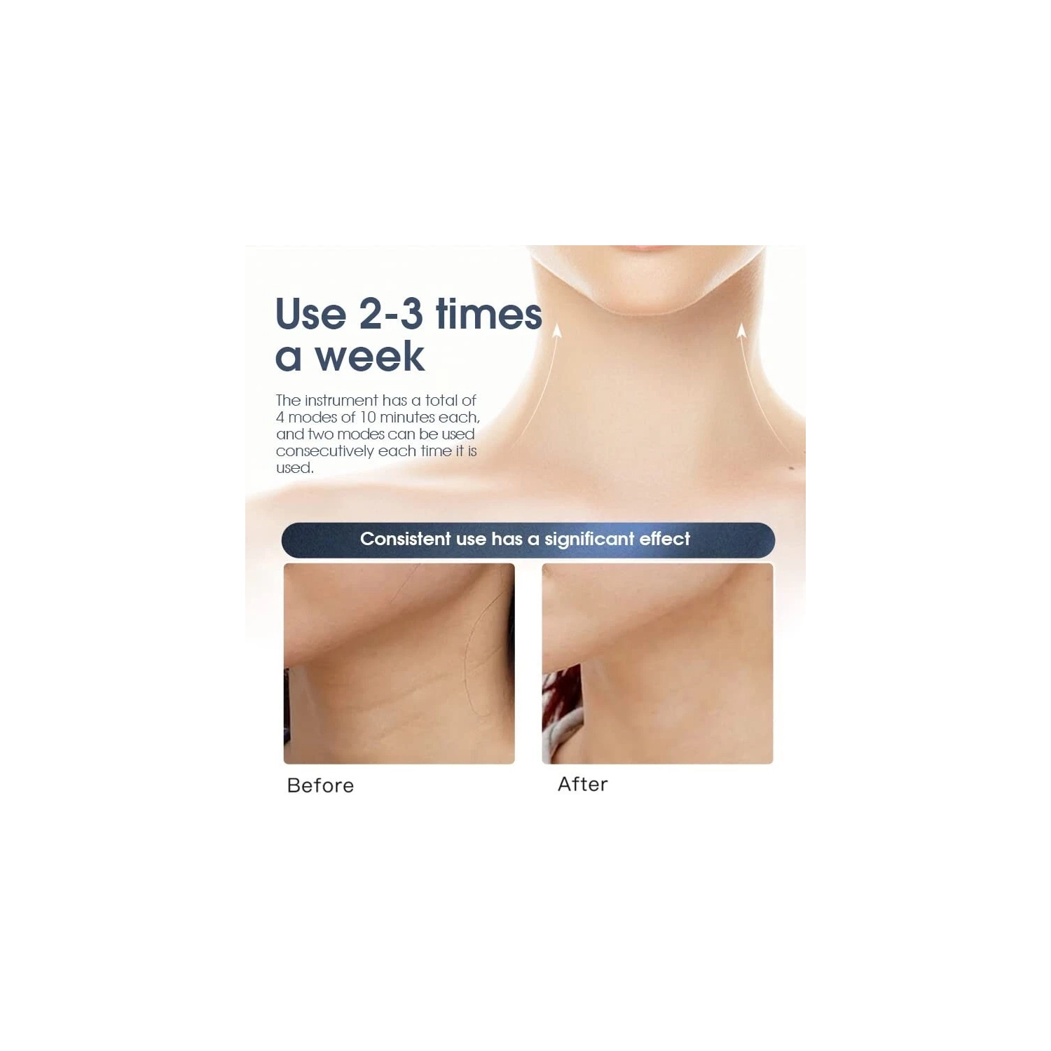 Soins du cou et élimination des plis Instrument Anti Aging Neck Lift Appareil de soin de la peau électrique pour le cou