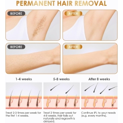 Laser Hair Removal Device for Home Use,IPL Permanent Painless Hair