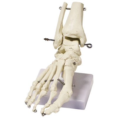 Image of Walter Products Foot Skeleton Model