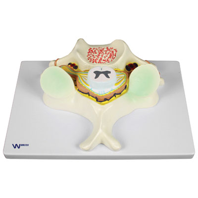 Image of Walter Products 5th Cervical Vertebrae Model