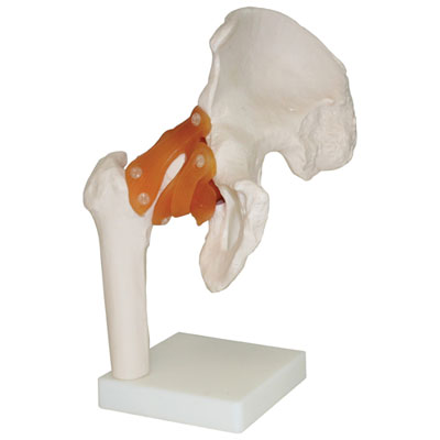 Walter Products Life-Size Human Hip Joint Model 