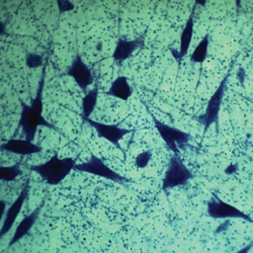 Ensemble de lames préparées de criminalistique de Walter Products - 17 pièces