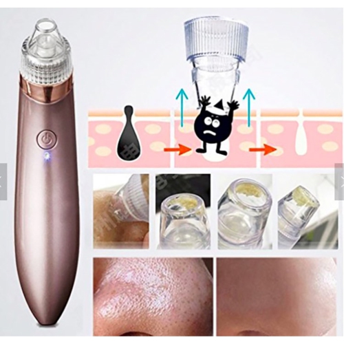 ZfLogic Magic Blackhead Remover w/ Vacuum Suction Heads- White