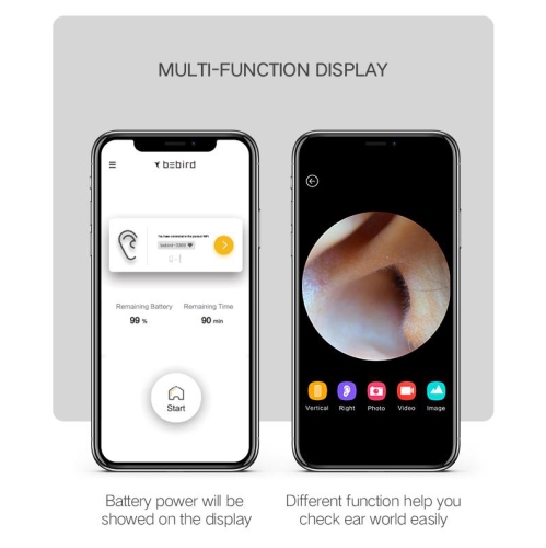 BEBIRD A2 Otoscope intelligent visible couleur argentée