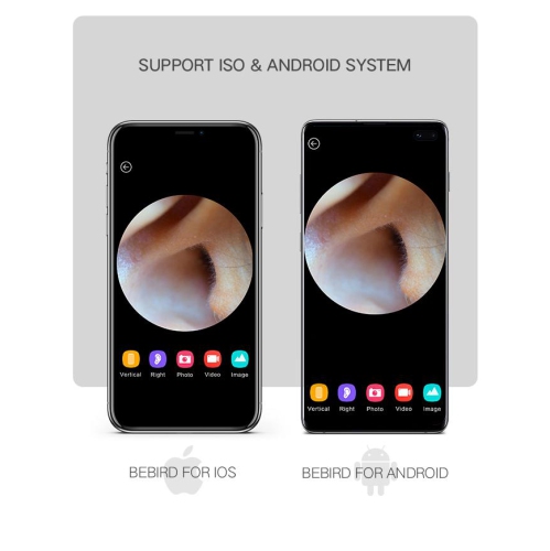 BEBIRD A2 Otoscope intelligent visible couleur argentée