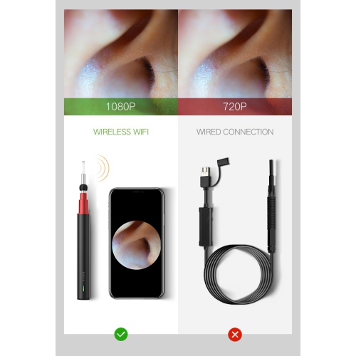 BEBIRD A2 Otoscope intelligent visible couleur argentée