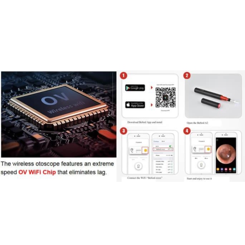 BEBIRD A2 Otoscope intelligent visible couleur argentée