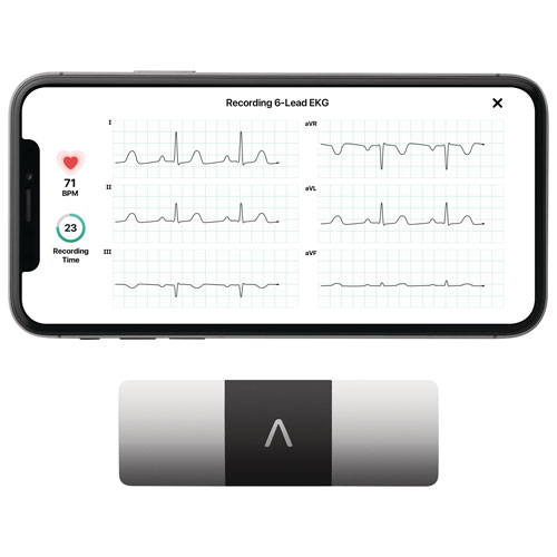 Moniteur d'ECG portatif KardiaMobile 6L