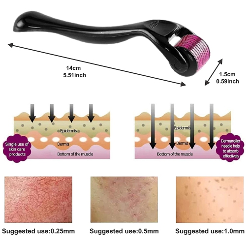 ISTAR Derma Roller 540 Titanium 0.5mm Micro Needle Cosmetic Microdermabrasion Tool For Face, Beard, and Hair Growth Includes Storage Case