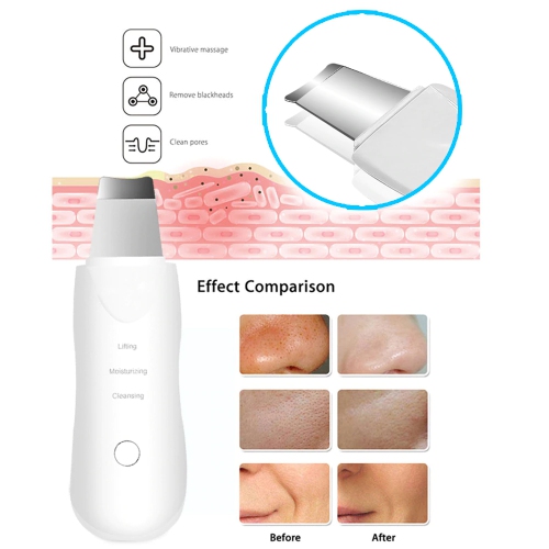 ISTAR Ultrasonic Skin Scrubber Spatula, Blackhead Remover Pore Cleaner with 4 Modes, Facial Scrubber Spatula, Comedones Extractor for Facial Deep