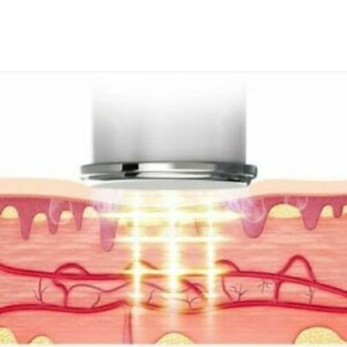 4 vibromasseur pour le cou et les épaules soulagement des douleurs musculaires Vibrate