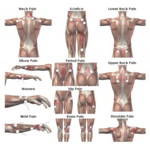 Appareil EMS TensCare Sport TENS 2 pour le soulagement de la douleur et la stimulation musculaire