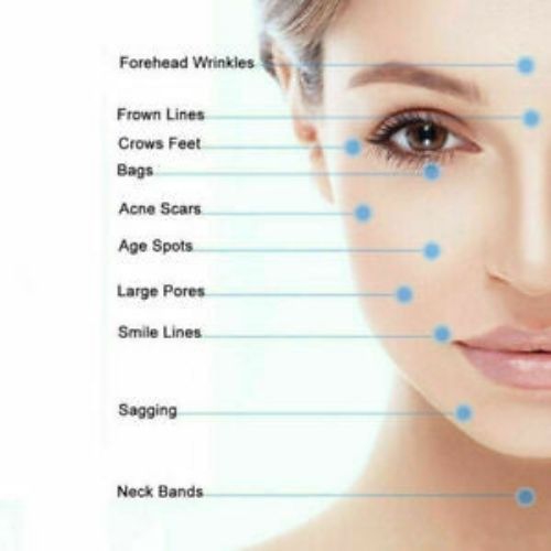 540 Titanium Micro Needle Derma Roller Beard Hair Regeneration Growth Skin Care✅