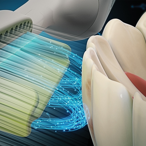 ToothWave by Silk'n DentalRF Technology Toothbrush