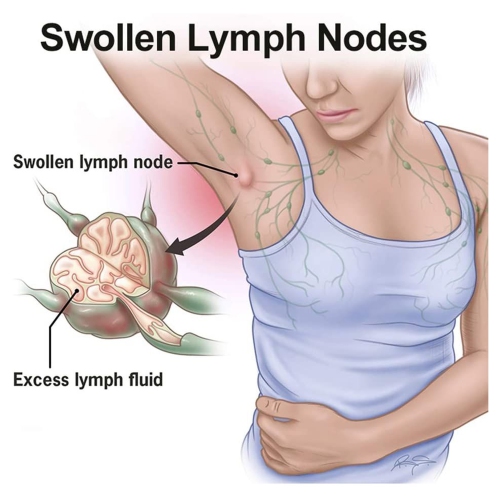 10Pcs Biolita Lymphatic Care Patch Mammary Elimination Patch Lymph Patch