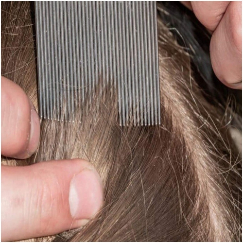 Multi Function Brush Stainless Steel Pet Remove Flea Comb Pet Dog Hair Grooming Comb Cat and dog Cleaning Supplies