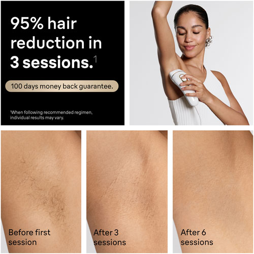 Braun Silk Expert Pro 5 Dry IPL Hair Removal System