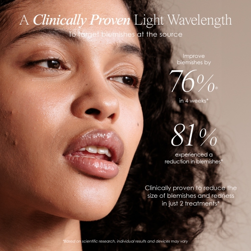 Project E Beauty Blue LED+ | Acne Light Therapy | Anti-Blemish | for Oily Skin | Reduce Dark Spots & Scars | Calm Inflammation