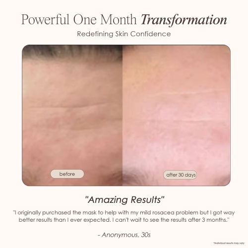 Project E Beauty LightAura LED Face Mask | 7-Color LED Face Mask | LED Light Therapy | Anti-Aging | Anti-Blemish | Boost Collagen