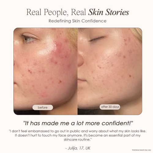 Project E Beauty LightAura LED Face Mask | 7-Color LED Face Mask | LED Light Therapy | Anti-Aging | Anti-Blemish | Boost Collagen