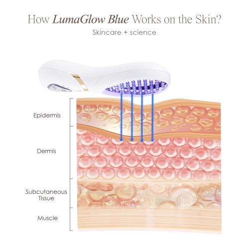 Project E Beauty LumaGlow Blue LED Light Therapy | Anti Acne | Pimple Solution | For Oily Skin | Minimize Pores | FDA-Cleared