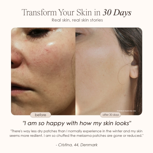 Project E Beauty Lumamask 7 | LED Light Therapy Face Mask | 7 LED Colors | with Red Light Therapy | Anti-Aging & Anti-Blemish