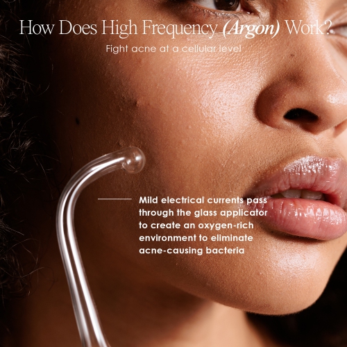 Project E Beauty Faisca Argon | High Frequency Wand | Anti-Acne | Tighten & Lift | Wound Healing | Prevent Hair Loss