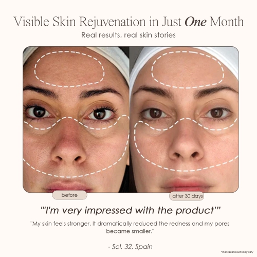 Project E Beauty Lumamask Pro | LED Light Therapy Face Mask | Infrared, Red & Blue Light Therapy | Anti-Wrinkle & Anti-Acne